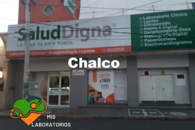 Salud Digna Chalco