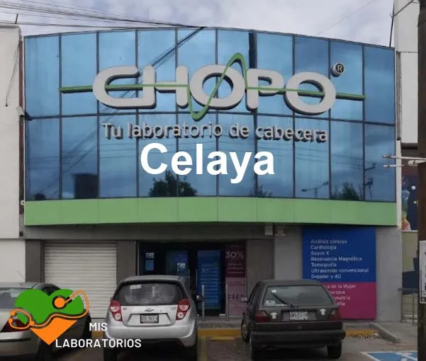 Chopo Celaya