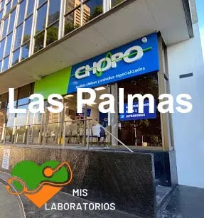 Chopo Las Palmas