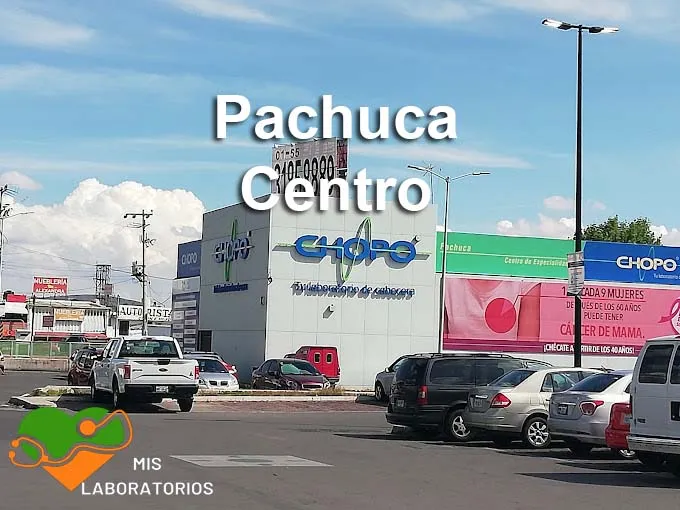 Chopo Pachuca Centro