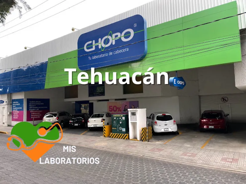 Chopo Tehuacán