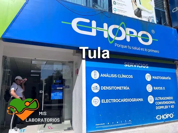 Chopo Tula