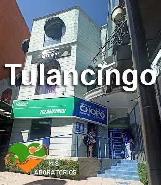 Chopo Tulancingo