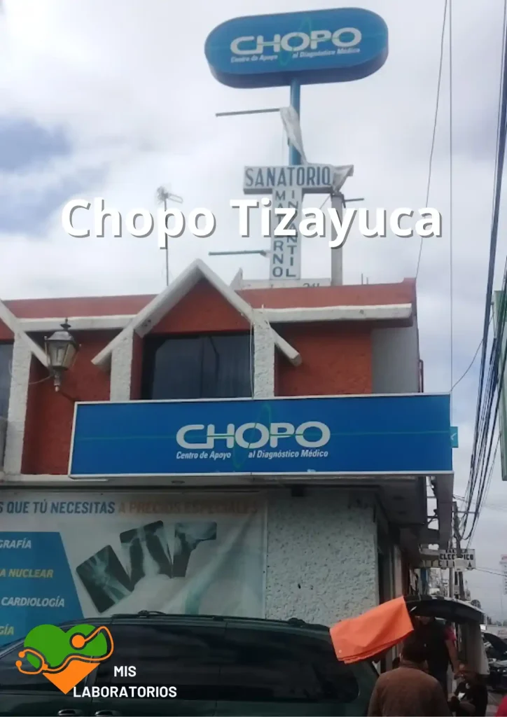 Chopo Tizayuca