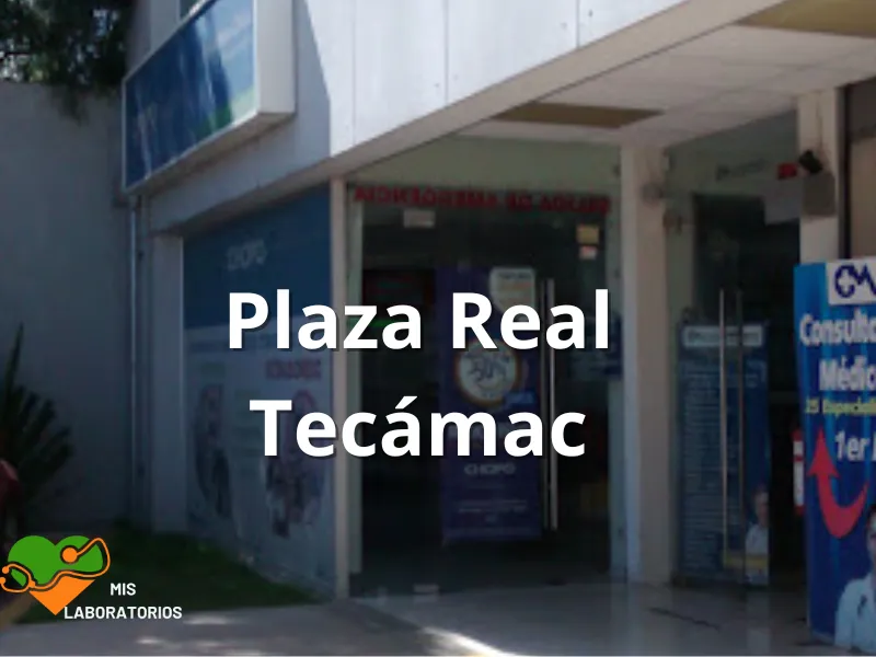 Chopo Plaza Real Tecamac