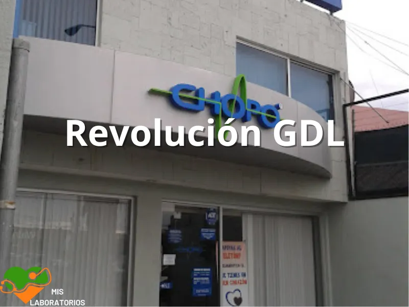 Chopo Revolución GDL