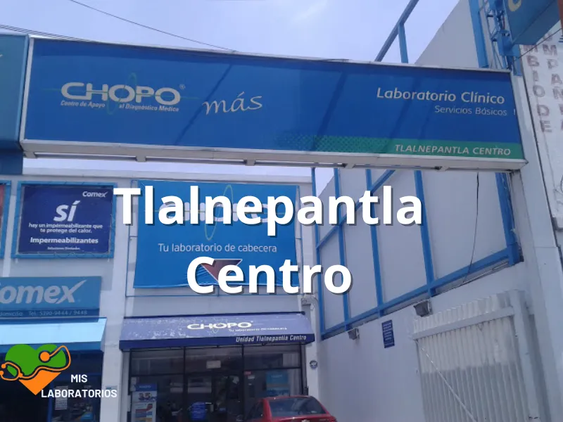 Chopo Tlalnepantla Centro