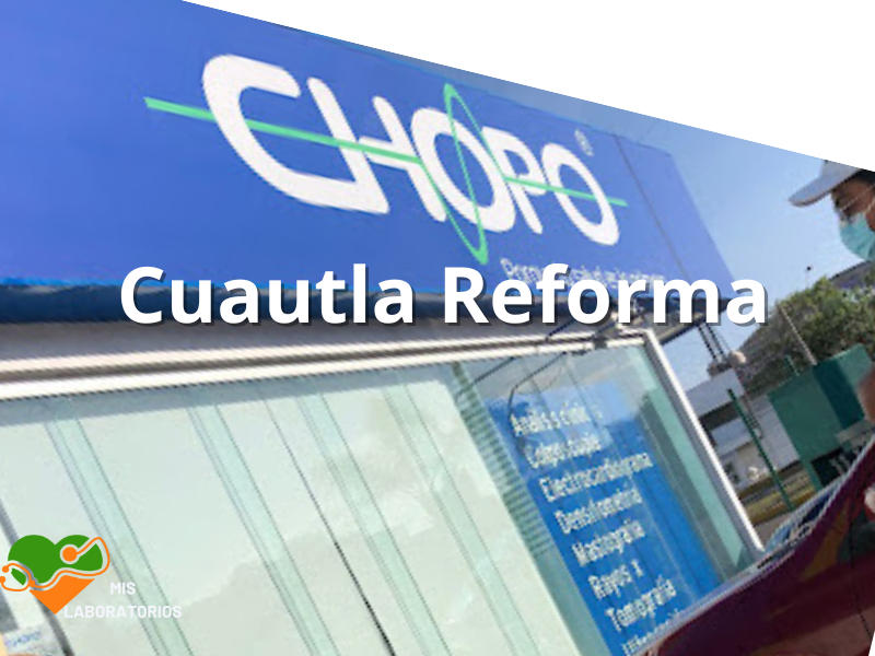 Chopo Cuautla Reforma