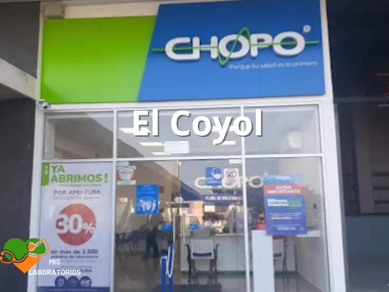 Chopo El Coyol