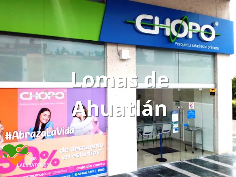 Chopo Lomas de Ahuatlán