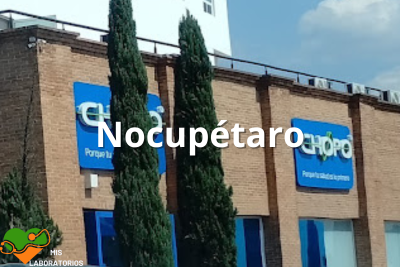 Chopo Nocupétaro