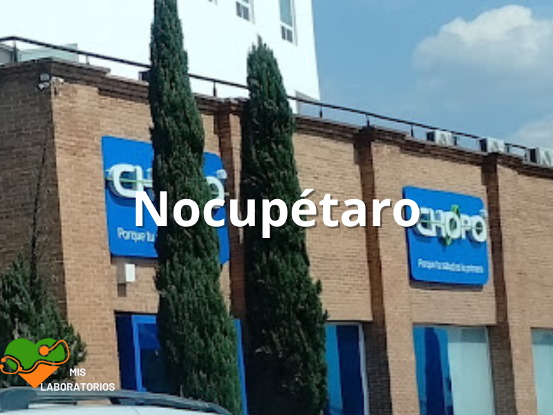 Chopo Nocupétaro