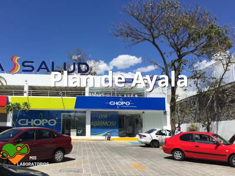 Chopo Plan de Ayala