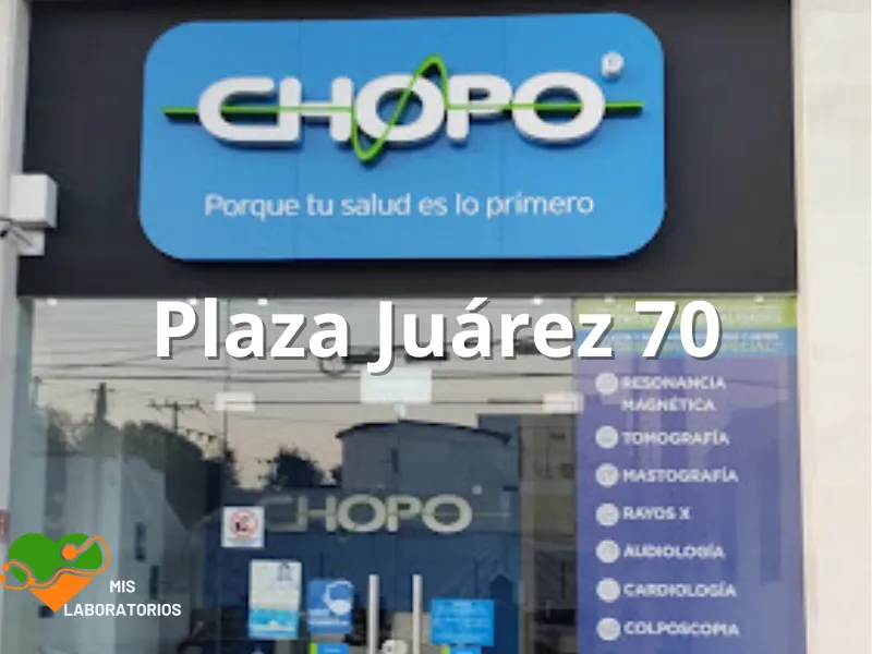 Chopo Plaza Juárez 70