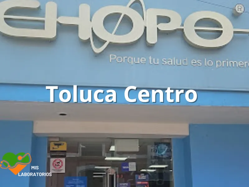 Chopo Toluca Centro