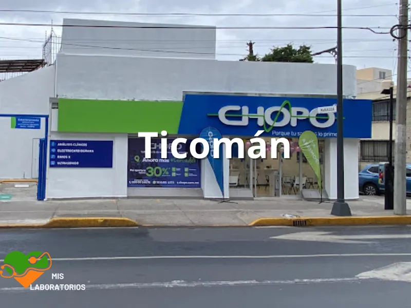 Chopo Ticoman