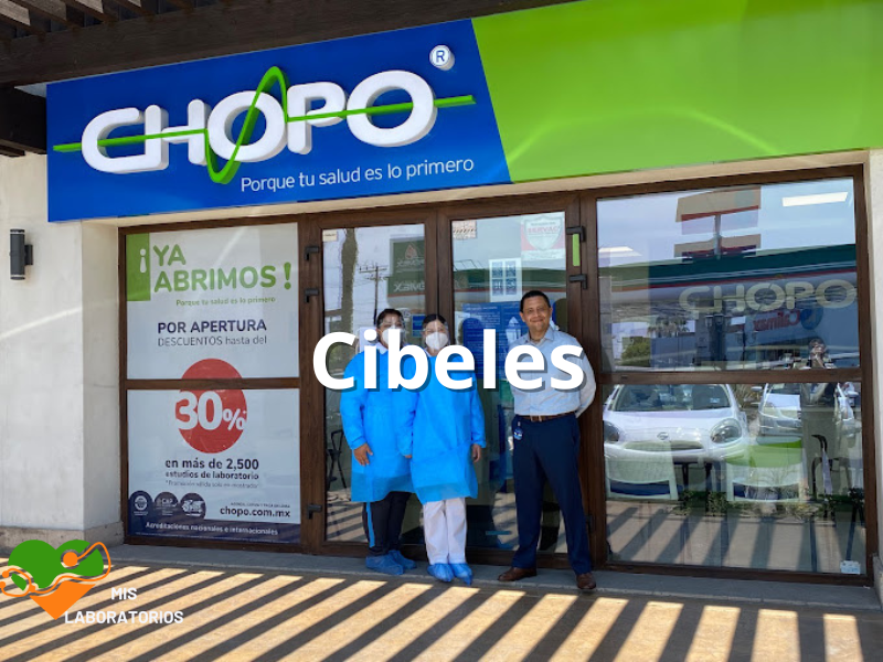 Chopo Cibeles