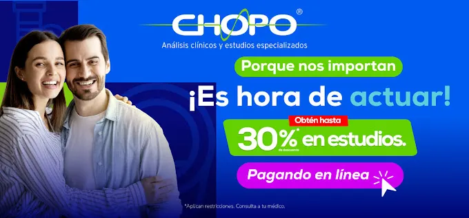 Chopo Itzaes Precios y Estudios