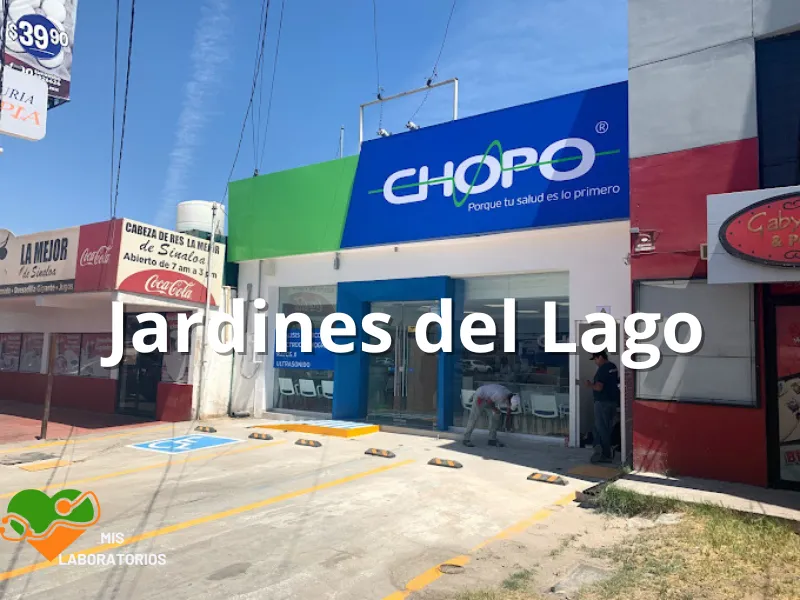 Chopo Jardines del Lago