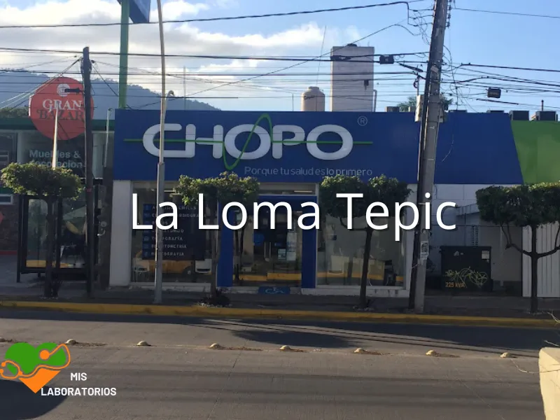 Chopo La Loma Tepic