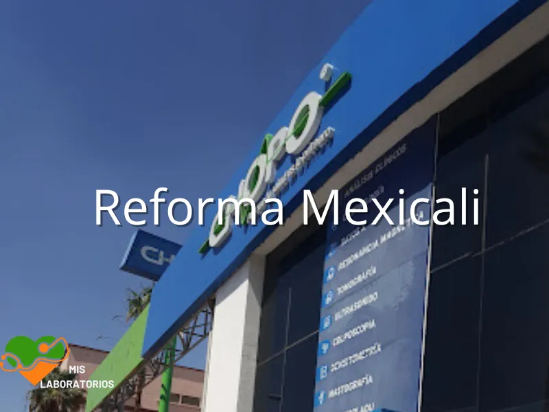 Chopo Reforma Mexicali