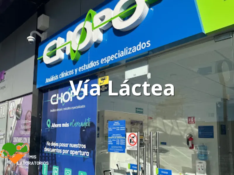 Chopo Vía Lactea