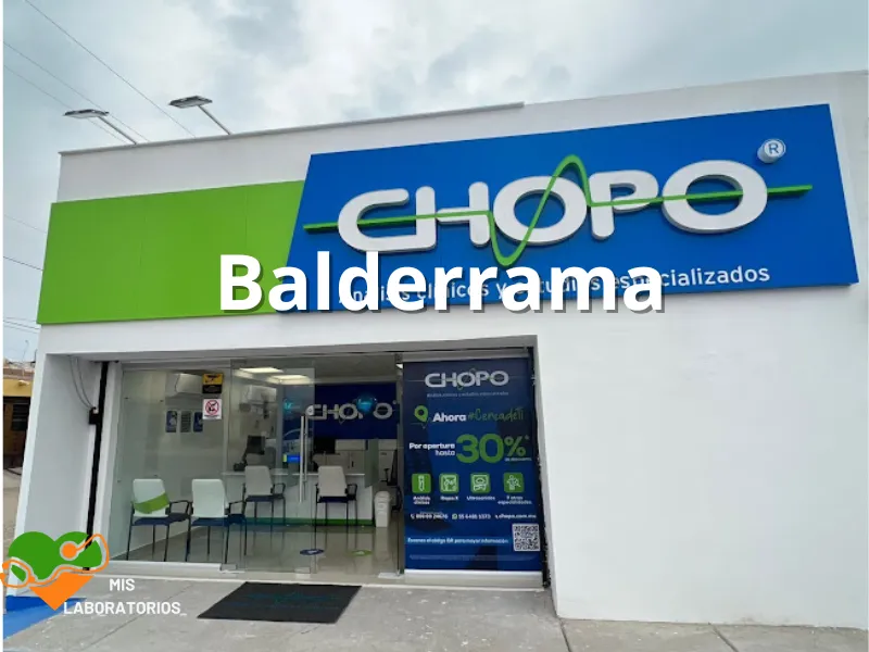 Chopo Balderrama