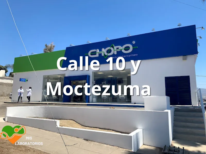 Chopo Calle 10 y Moctezuma