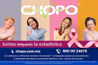 Chopo La Fragua