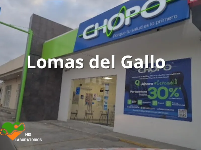 Chopo Lomas del Gallo