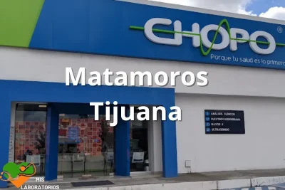 Chopo Matamoros Tijuana