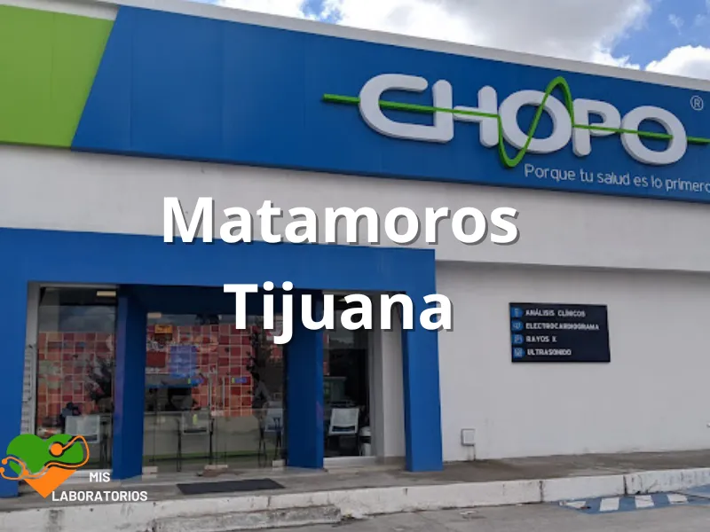 Chopo Matamoros Tijuana