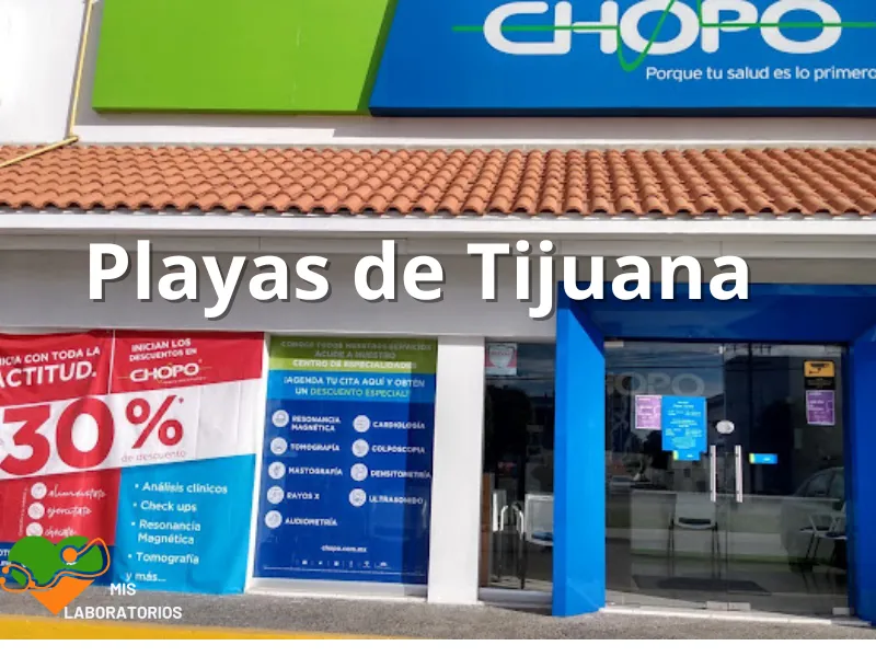 Chopo Playas Tijuana