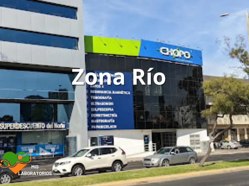 Chopo Zona Río