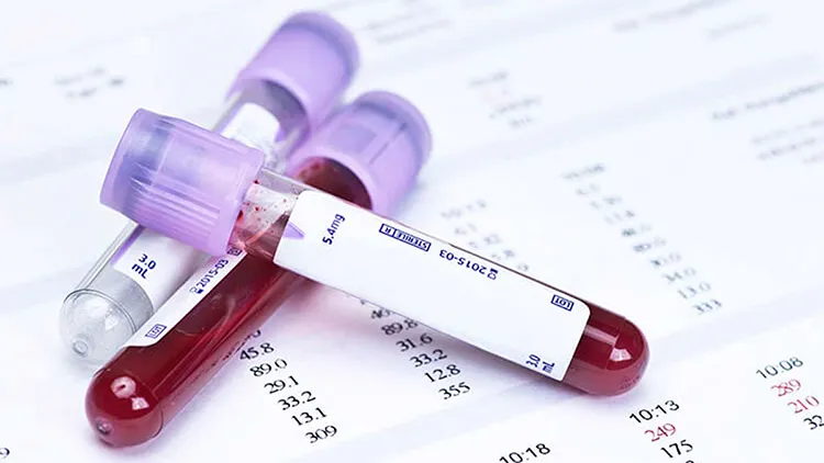 costo examen ets en laboratorios mexico